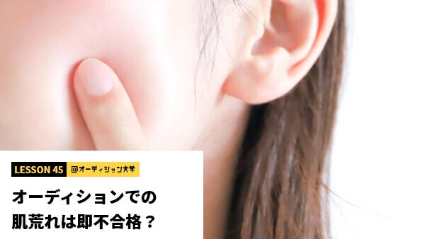 オーディションでの肌荒れは即不合格？